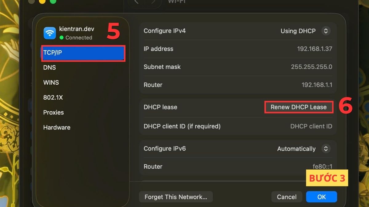 Chọn TCP/IP và Renew DHCP Lease