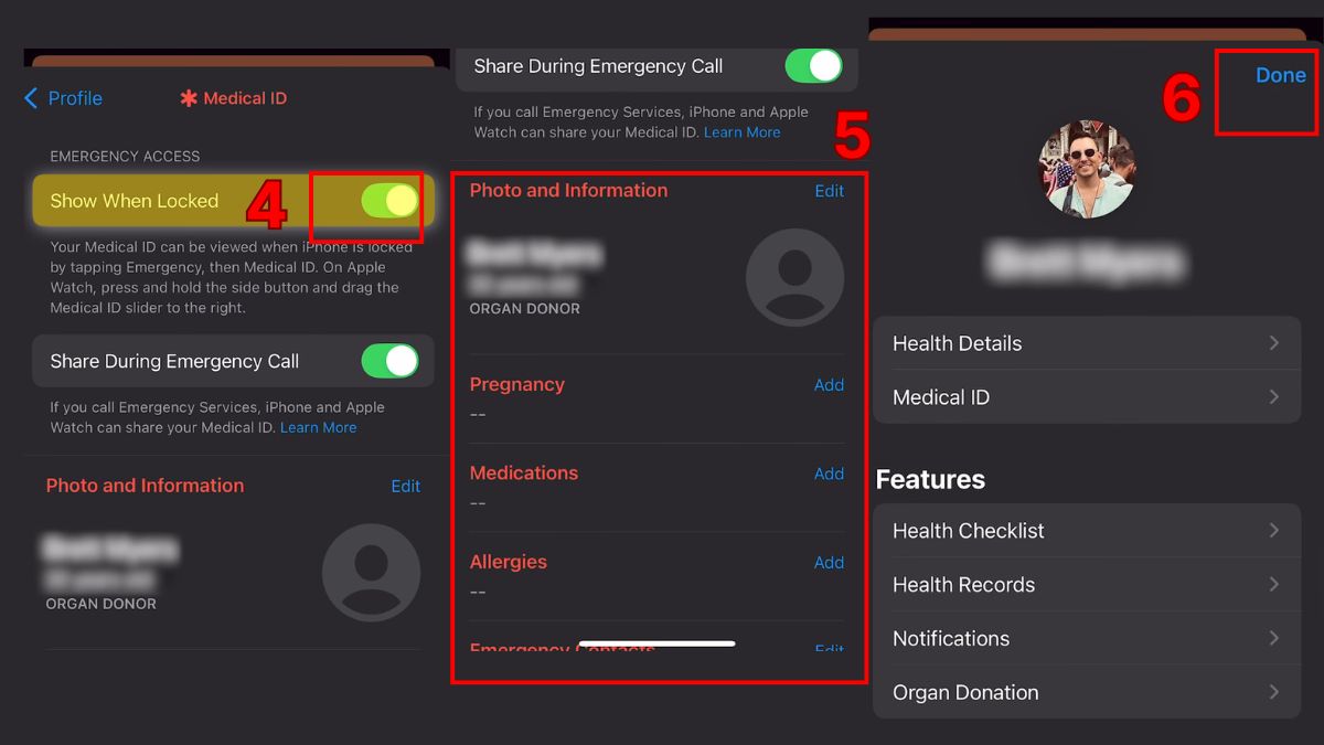 Thiết lập ID Y tế và thông tin khẩn cấp khi cài đặt Apple Watch Series 10.