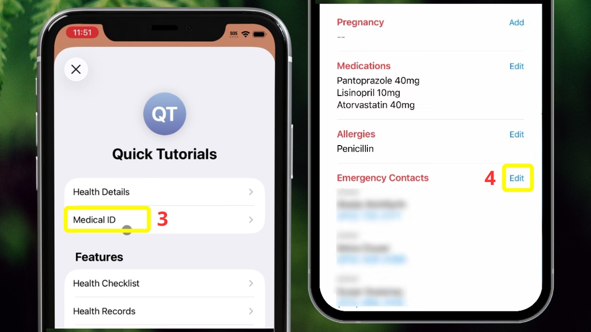 Cách xóa liên hệ khẩn cấp trong SOS iPhone - bước 2