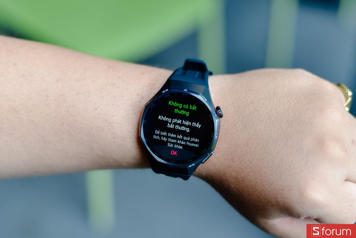 Đồng hồ còn được tích hợp các tính năng như phân tích điện tâm đồ (ECG) và phân tích rối loạn nhịp tim