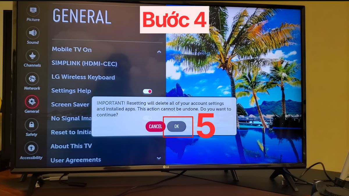 Khôi phục cài đặt gốc (reset) tivi LG bước 4
