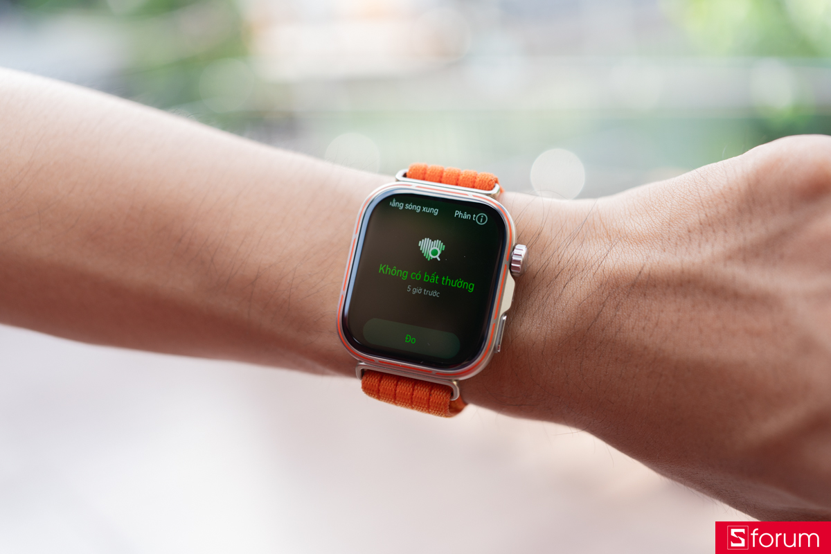 Đo rối loạn nhịp tim bằng sóng xung trên Huawei Watch Fit 5 Pro