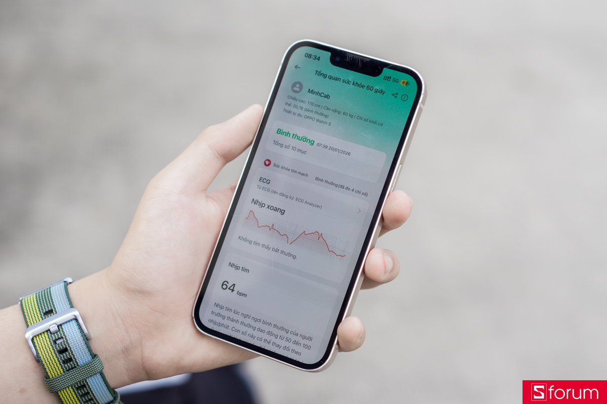 OPPO Watch S sử dụng hệ điều hành RTOS, cho phép dễ dàng kết nối với cả thiết bị Android lẫn iOS thông qua ứng dụng OHealth