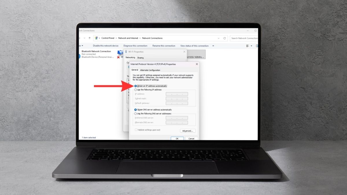 Tích vào mục Obtain an IP address automatically
