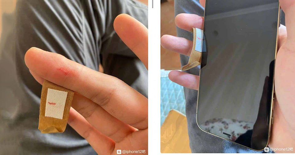 Người dùng iPhone 12 bị đứt tay vì cạnh viền điện thoại quá sắc Người dùng iPhone 12 bị đứt tay vì cạnh viền điện thoại quá sắc